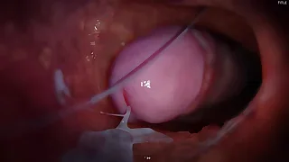 China Twink XXX Tube 13